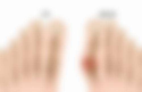 瘦脸针的危害和副作用