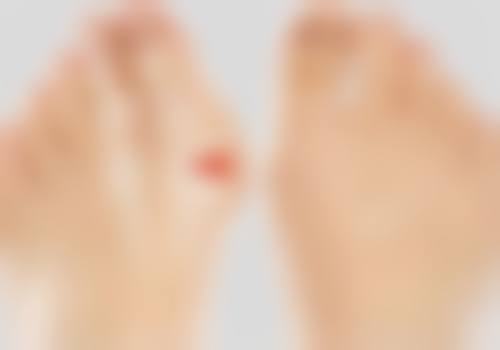 睡觉用嘴呼吸的其他注意事项