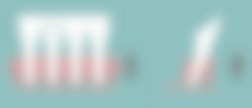 头发可以种吗？需要多少钱