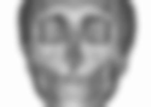 瘦脸针去哪里打？