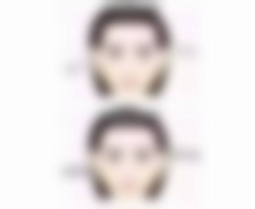 瘦脸针去哪里打