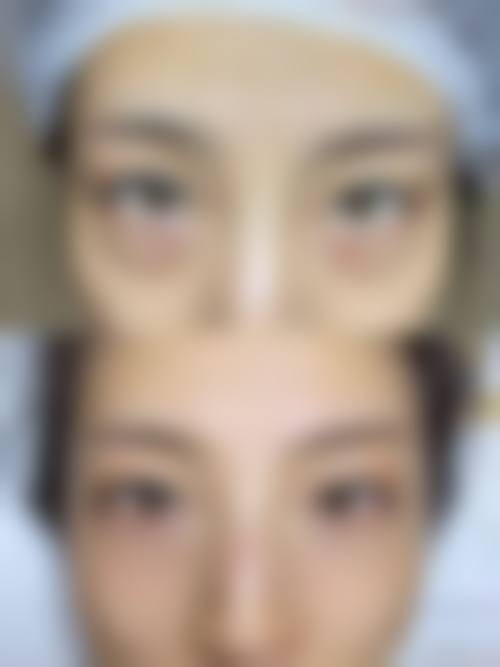 【邓淑玲医生口碑】