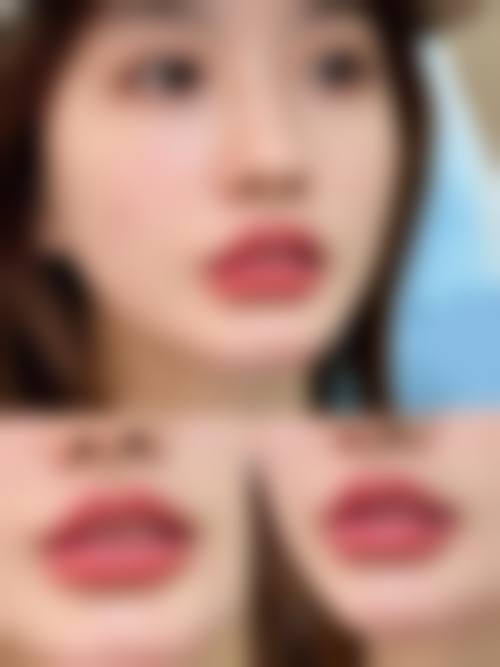 【杭州维俪肤整形医疗美容诊所核心优势:】