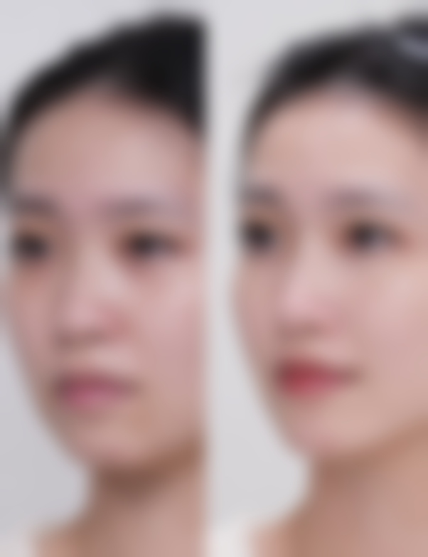 【重庆美联臣医疗美容诊所参考价格表：】