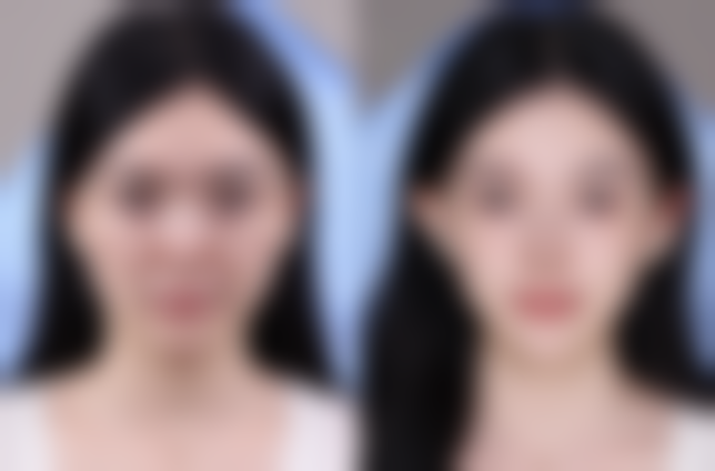 【海南海口梦妮幻整形医院参考价格表：】