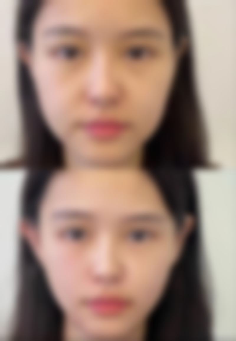 睡觉用嘴巴呼吸是什么原因