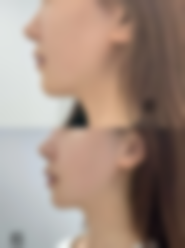 【罗登锋医生口碑怎么样?】