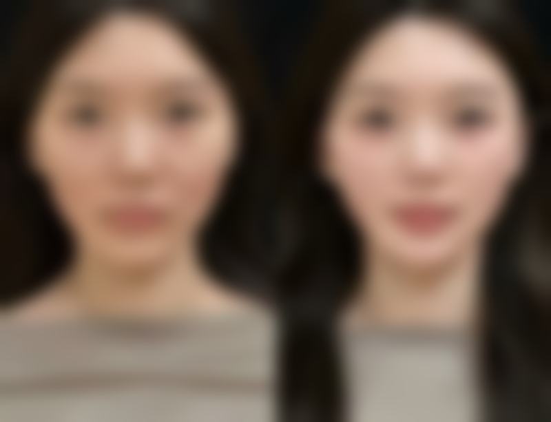 睡觉用嘴呼吸怎样改善