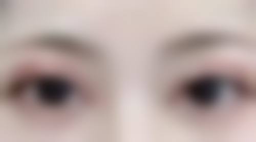 如何看待嘴唇厚与薄的差异