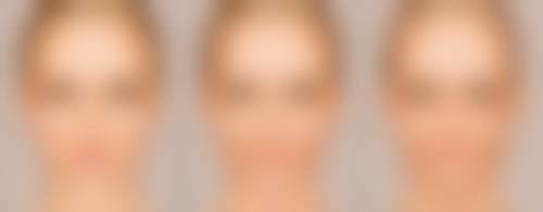 厚唇改薄手术多少钱