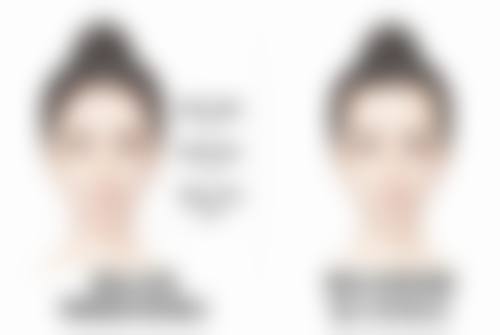 厚唇改薄去医院还是整容医院