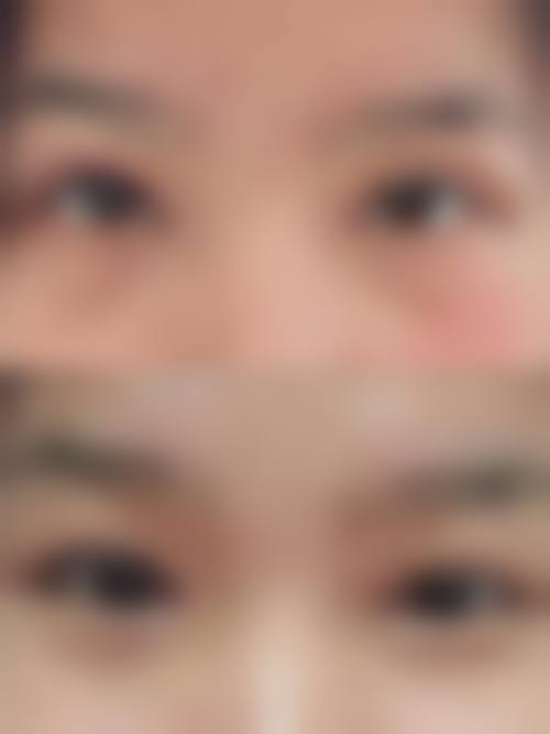 【袁宗毅医生技术特点】