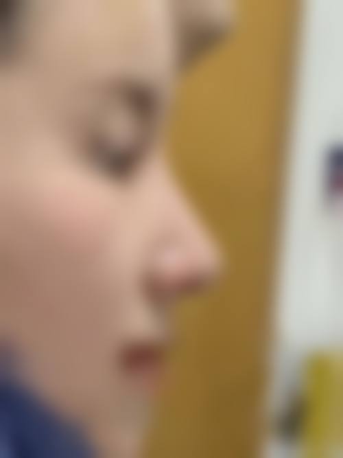 【吉林芳澜医疗美容门诊部怎么预约挂号?】