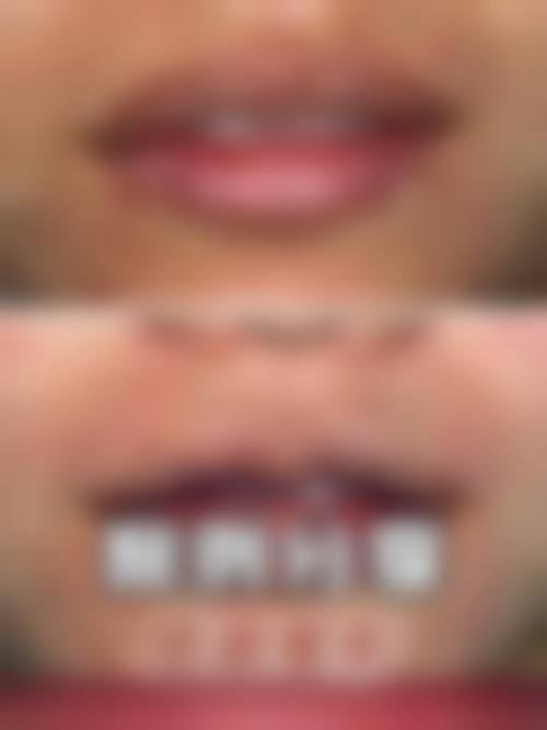 【宁夏银川田永成整形参考价格表：】