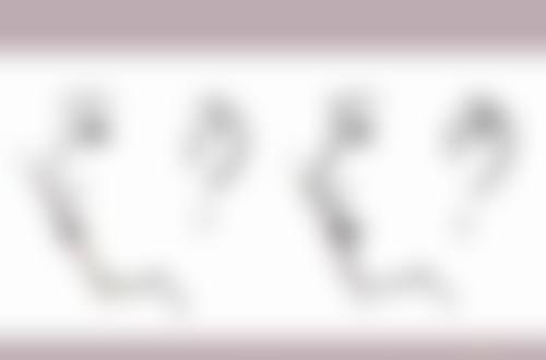 有打瘦脸针一次就有永久效果的吗？揭秘瘦脸针维持时长真相，3大因素决定效果，让你科学变美！ 