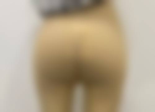 种植头发后需要多久恢复？4 大阶段揭秘恢复时间表，助你快速拥有浓密秀发重展自信！ 