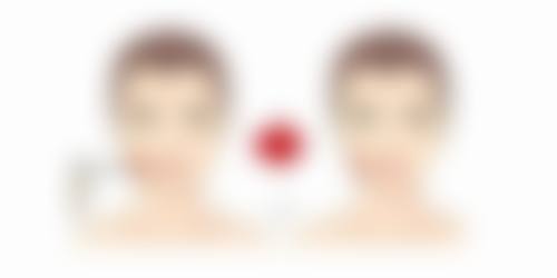 有打瘦脸针一次就有恒久成效的吗多少钱