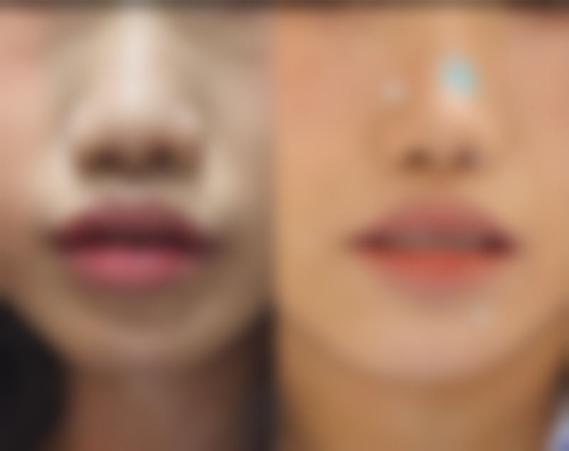 【郑州杨丽美颜医疗美容门诊部是正规的吗?】