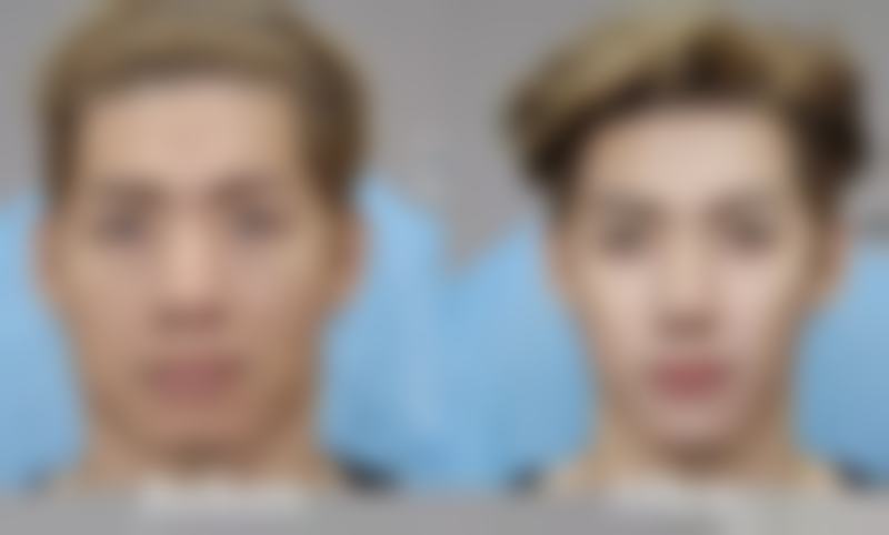 打瘦脸针需要注意什么