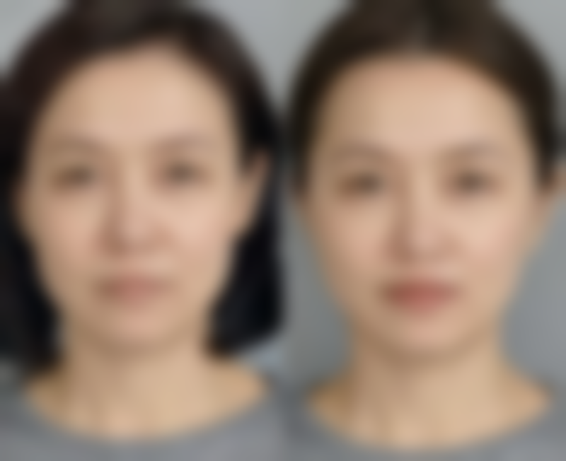 【广州市第十二人民医院整形美容科是正规的吗?】