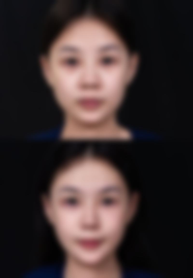 【广州市第十二人民医院整形美容科参考价格表：】