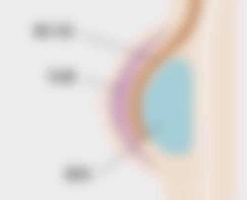 【袁宗毅医生擅长项目】