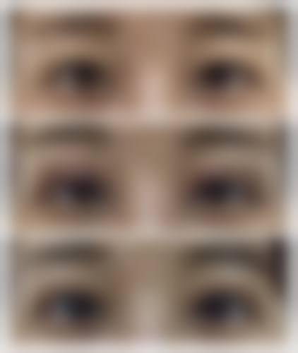 【袁宗毅医生擅长项目】