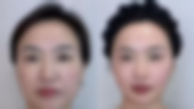 【昆山米扬丽格医疗美容门诊部患者口碑评价:】