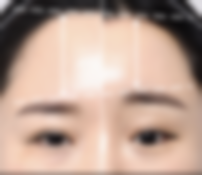 一根头发都没有可以种植吗