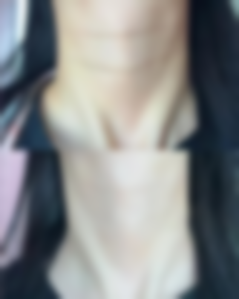 嘴角下垂纹怎么消除更快