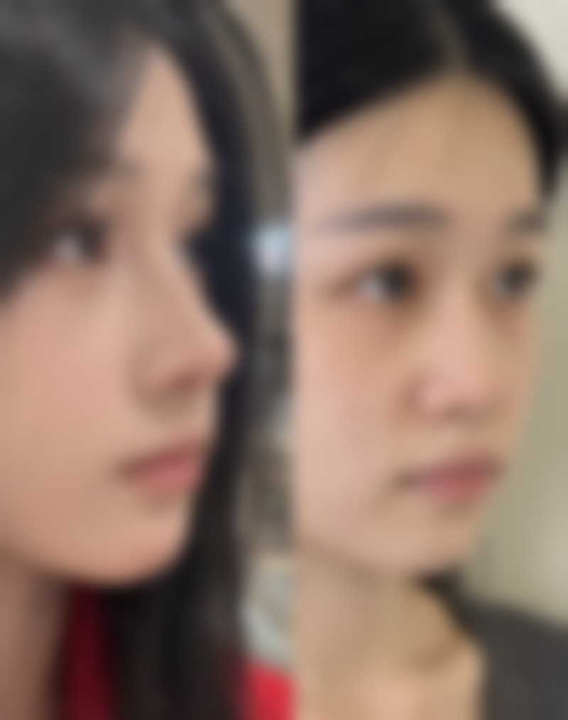 头发种植价格一般多少钱