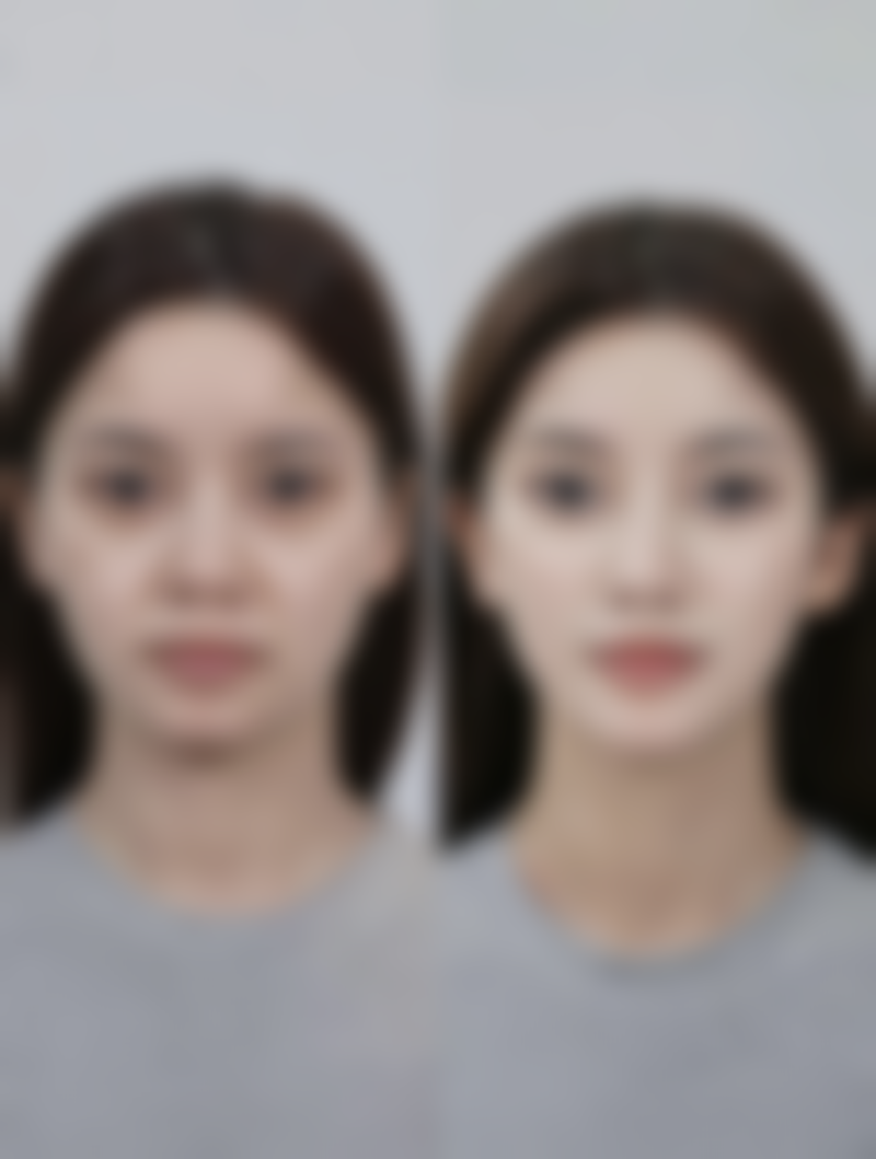 【成都美蕊牙科诊所参考价格表:】