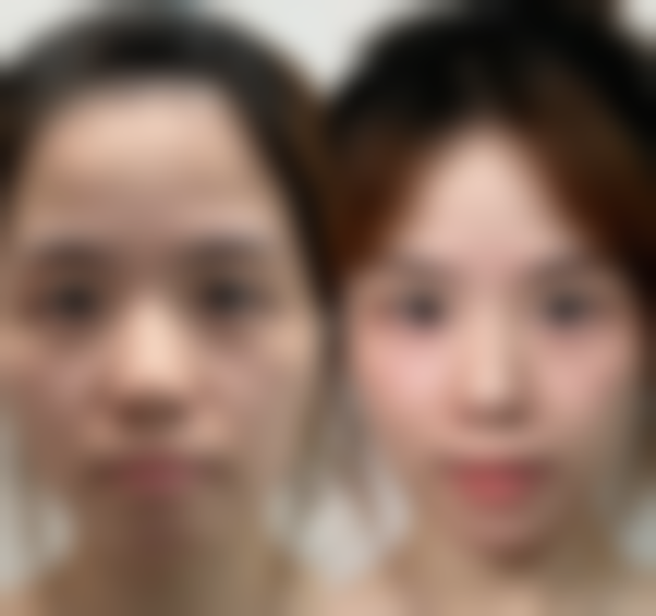 【何荣国医生口碑怎么样?】