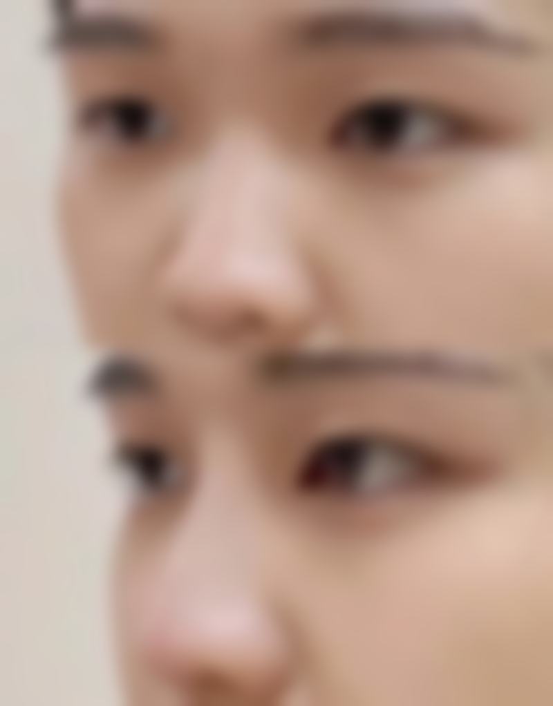 【南充达芬奇整形医院地址：】