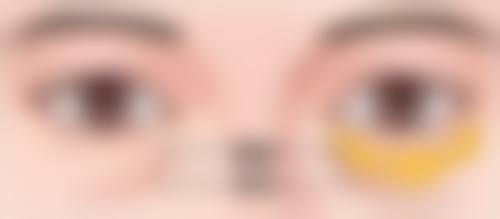 瘦脸针成效维持时间与补打