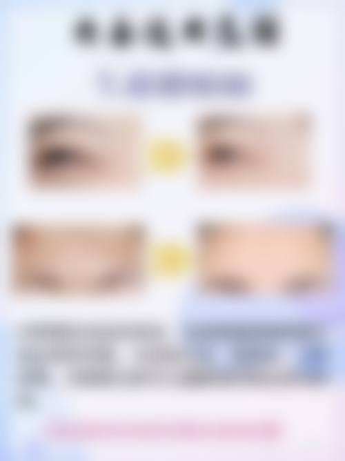 玻尿酸除皱针的危害和副作用