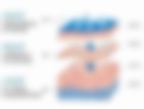 瘦脸针一般打50单位还是100单位