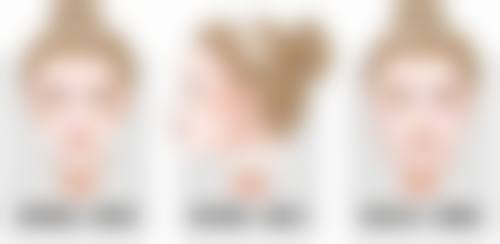 玻尿酸除皱多少一针？揭秘不同品牌、剂量价格区间，教你选性价比高方案，告别皱纹不再贵！ 