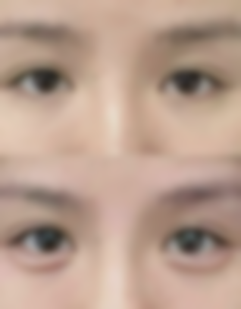 扬州赫本医疗美容门诊部怎么预约挂号?