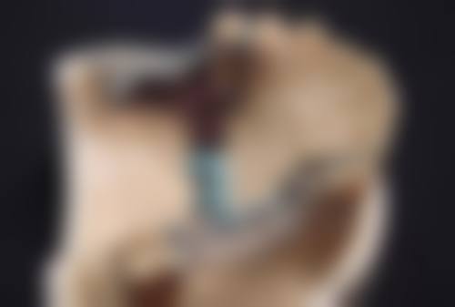 打完瘦脸针没有任何感觉正常吗？权威揭秘：90%没感觉属正常现象，详细剖析背后的科学原因！ 