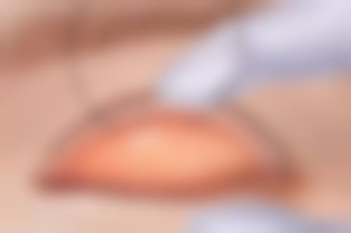 需要警惕的异常情况