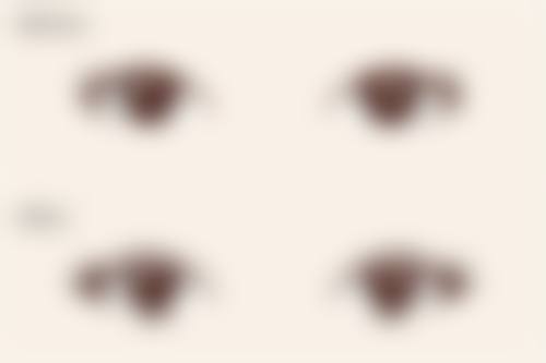 瘦脸针会持续多久