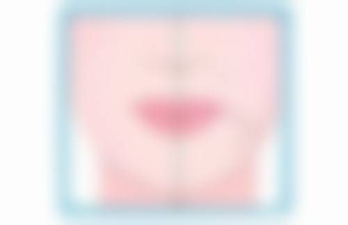 南光贵妇美白针一盒几次