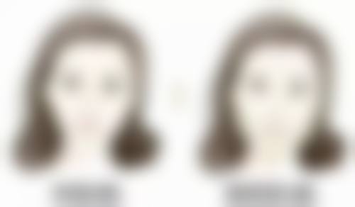 打完瘦脸针多久成效更明显