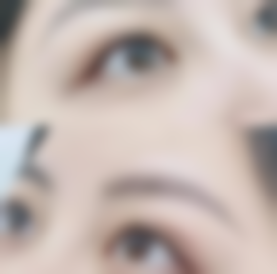 热玛吉有什么成效和副作用