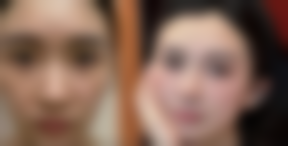 瘦脸针打完多久成效更明显