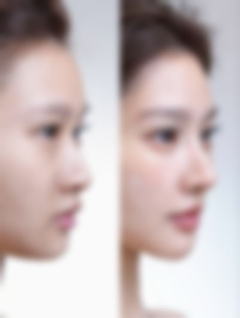 【襄阳双较好医疗美容门诊部怎么预约挂号?】