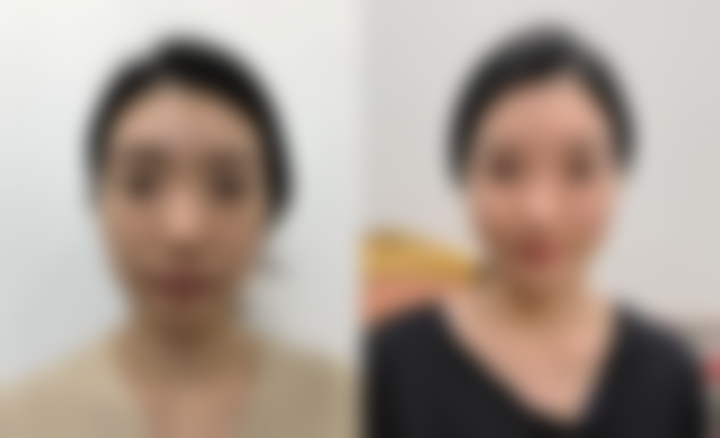 嘴歪脸不对称挂什么科？