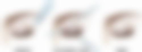 下嘴唇厚改薄的费用问题