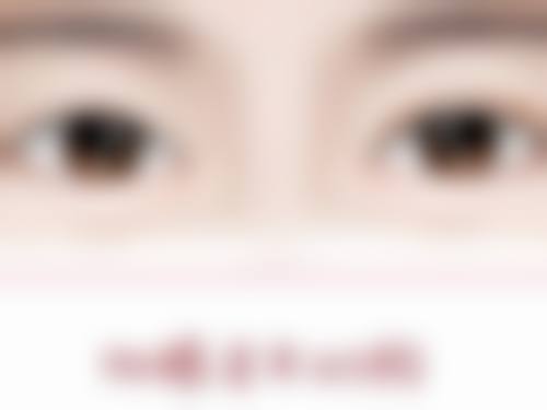 唇组织缺损不超过全唇的1/3处理方法